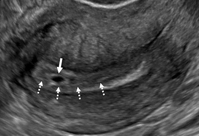 SRU develops new lexicon for ultrasound findings in pregnant women