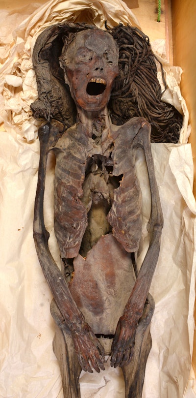 Mummified woman appears to have died in pain 3,500 years ago