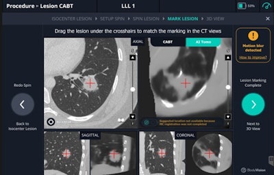 Body Vision Medical releases LungVision software update