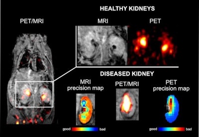 Researchers test dual PET/MRI imaging agent in mice