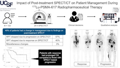 SPECT/CT improves management of Pluvicto patients
