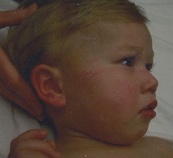 AuntMinnie 2010: Settlement reached in Mad River pediatric CT radiation case