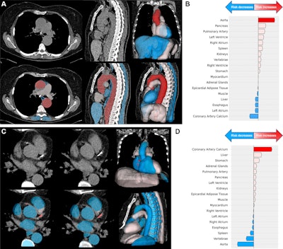 AI helps predict all-cause mortality from incidental chest CT findings