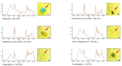 Microplastics reach the olfactory bulb in the human brain
