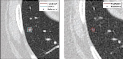 Caution needed when using LDCT with CAD systems for kids