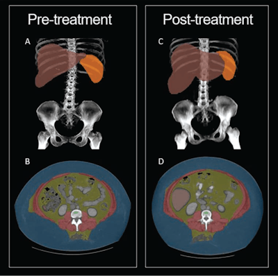 Body composition analysis, MRI safety topped 2024’s most read articles